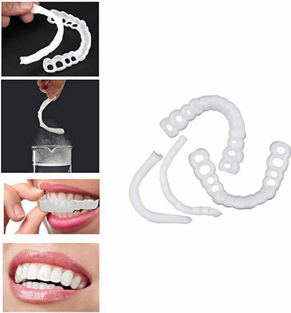Snap in Teeth | طقم أسنان تجميلي Snap-In