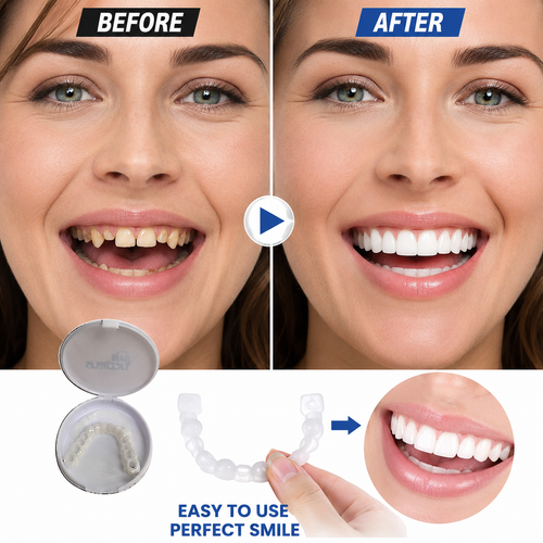 Snap in Teeth | طقم أسنان تجميلي Snap-In