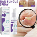 Gentle Nail Fungus Remover Maxum