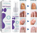 Gentle Nail Fungus Remover Maxum